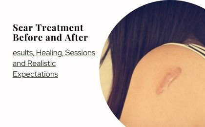 Scar Treatment Before and After—Results, Healing, Sessions and Realistic Expectations