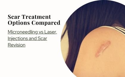Scar Treatment Options Compared—Microneedling vs Laser, Injections and Scar Revision