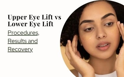 Upper Eye Lift vs Lower Eye Lift: Complete Comparison