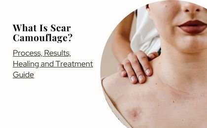 What Is Scar Camouflage? Process, Results, Healing and Treatment Guide